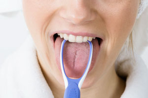 Die Reinigung der Zunge mithilfe des Zungenschabers